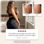 🍑Snoovely 3D Anti-Cellulite Leggings – Sculpt, Smooth & Shape with Every Step